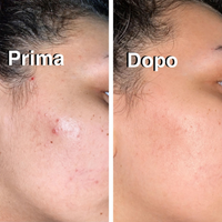 Prima e Dopo - UGC
