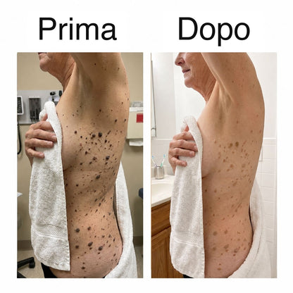 Prima e dopo sul fianco