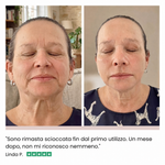 Alvionna I-Lift Testimonianza