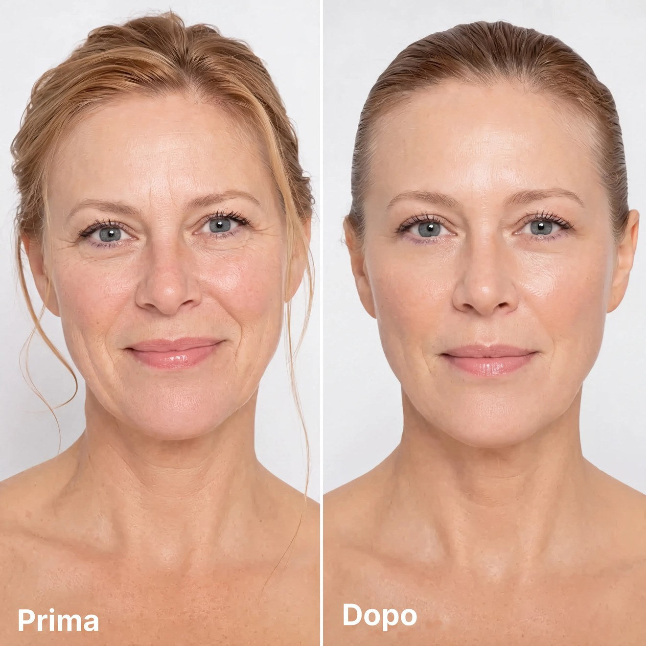 Prima e dopo — finish naturale