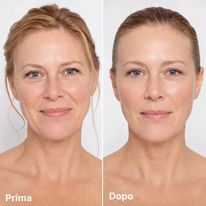 Prima e dopo — finish naturale
