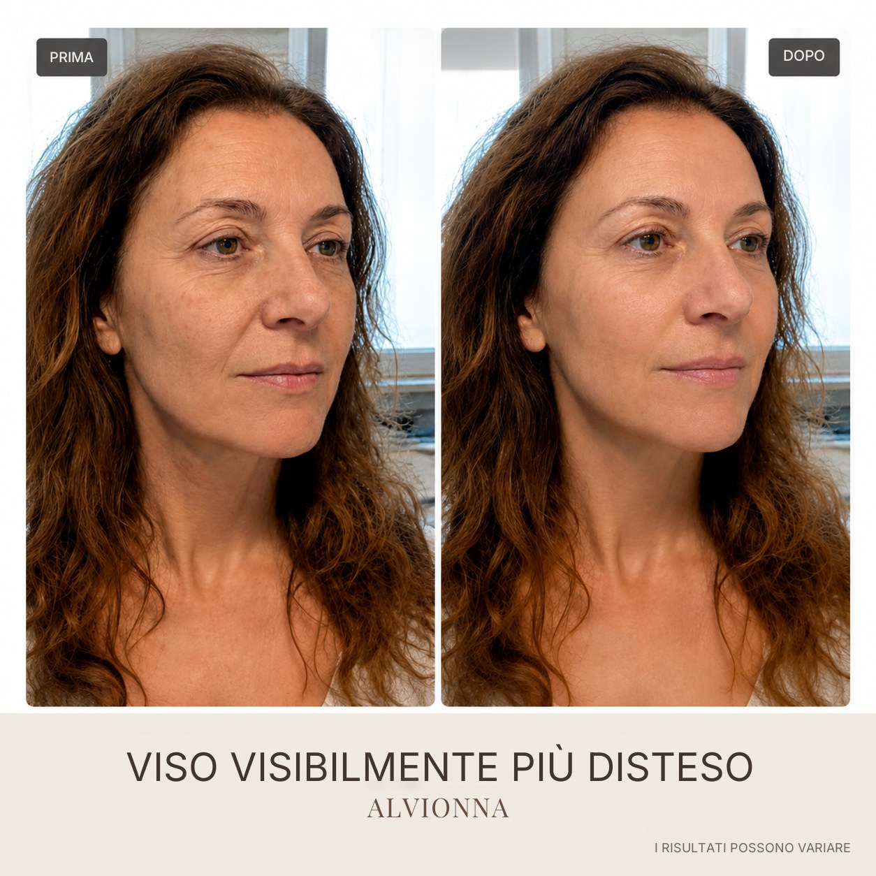 Prima e dopo viso disteso