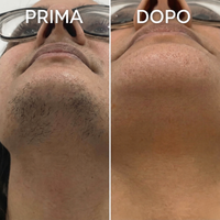 Prima e Dopo - Viso