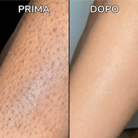 Prima e Dopo - Gambe