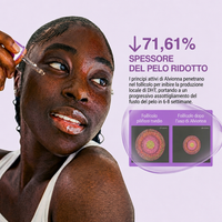 71,61% spessore pelo ridotto - Scienza del follicolo