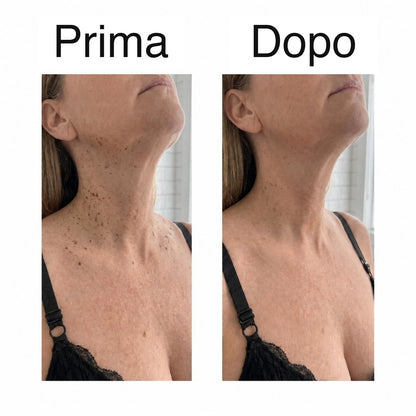 Prima e dopo sul collo