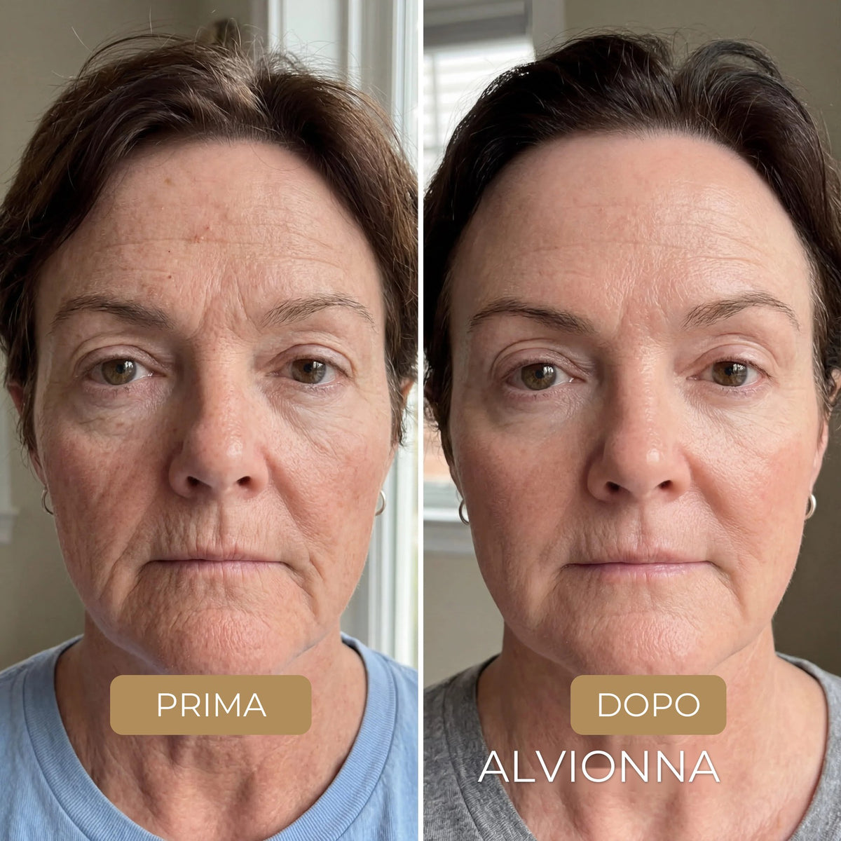 Prima e dopo la Maschera al Collagene Alvionna