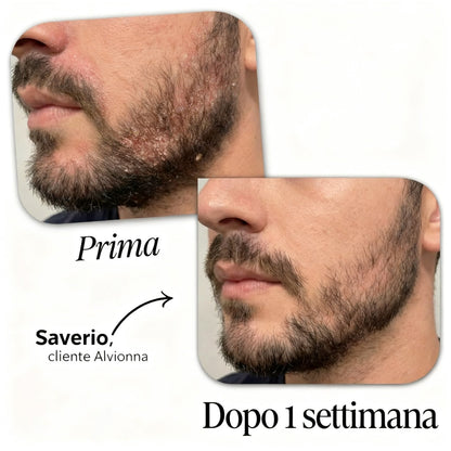 Siero Regolatore Alvionna