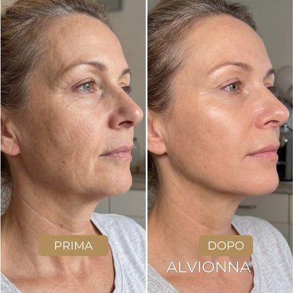 Prima e dopo la Maschera al Collagene Alvionna